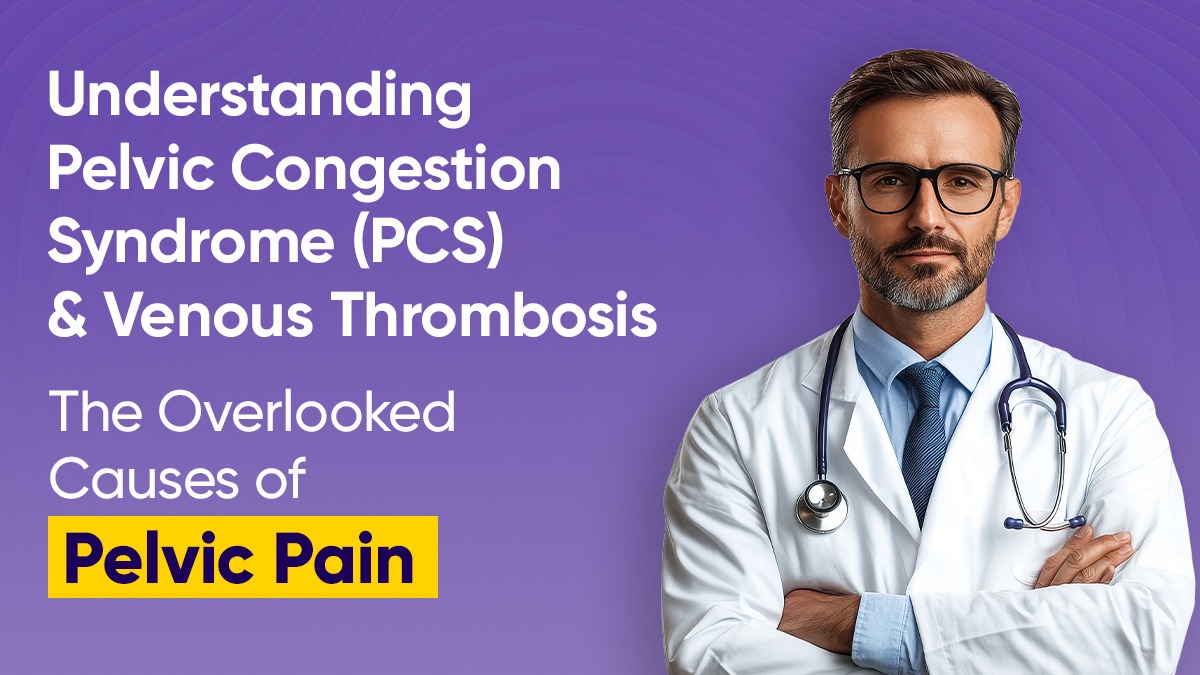 Understanding Pelvic Congestion Syndrome (PCS) and Venous Thrombosis: The Overlooked Causes of Pelvic Pain
